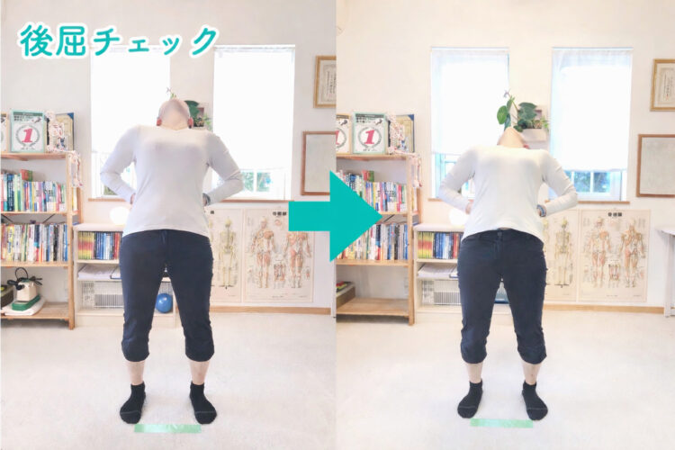 整体師による黄金のスクリーニング後、後屈動作の可動域が広がり、スムーズに体が動くようになった変化の比較画像