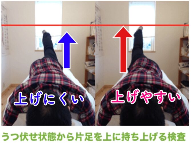 坐骨神経痛の根本原因を見極める足上げ検査:うつ伏せでの可動域チェック