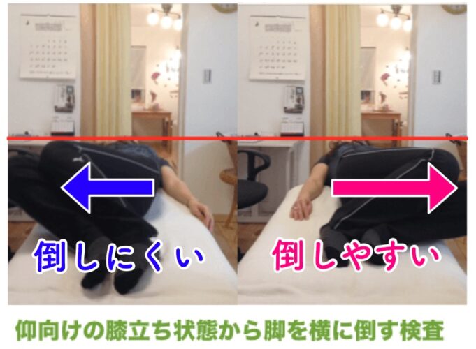 坐骨神経痛のスクリーニング検査:仰向けでの膝倒しチェック(左右差の確認)